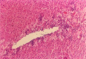 四塩化炭素により損傷を受けたマウス肝臓（200×）