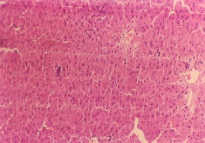 垂盆草エキス低容量＋四塩化炭素により損傷を受けたマウス肝臓（200×）