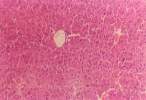 垂盆草エキス中容量＋四塩化炭素により損傷を受けたマウス肝臓（200×）