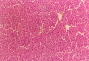 垂盆草エキス高容量＋四塩化炭素により損傷を受けたマウス肝臓（200×）